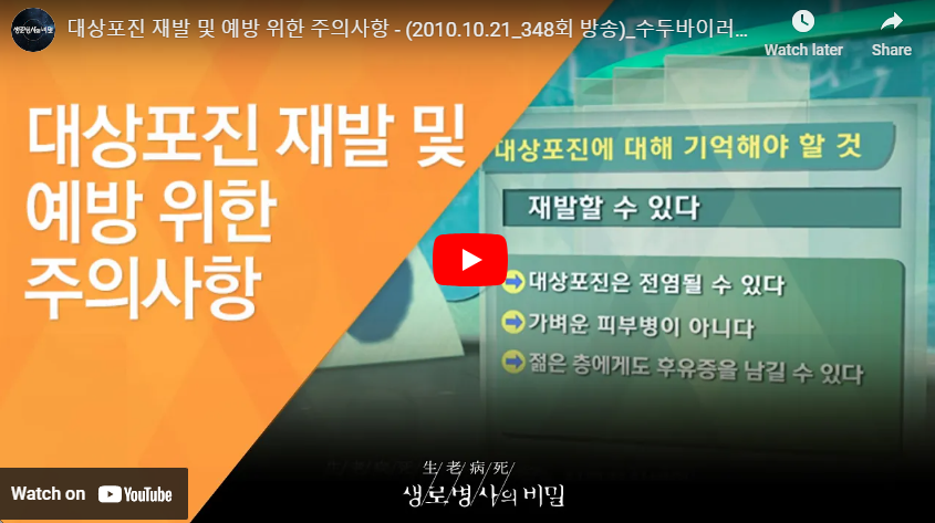 대상포진 재발 및 예방법 영상