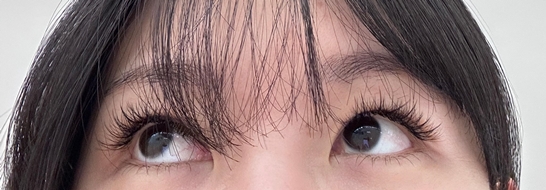 눈
