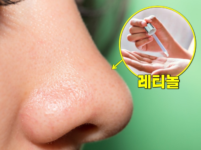 모공축소 화장품 레티놀 자연적으로 코 모공 줄이는 방법, 모공축소 시술 없이, 뷰티 팁줌 매일꿀정보