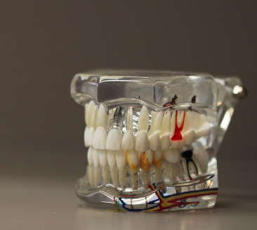 건강보험 임플란트 적용받는 방법, 보장범위와 비용