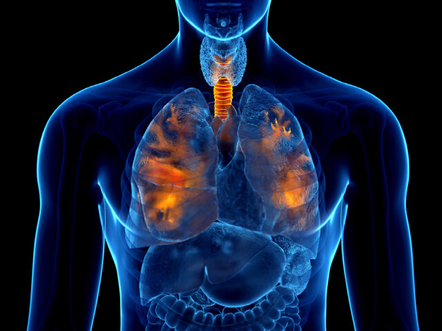 태음인 취약한 질환