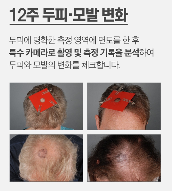 닥터포헤어 폴리젠샴푸
