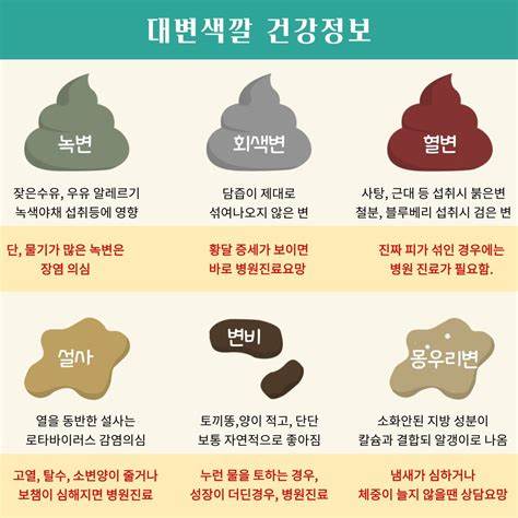 신생아 변 색깔