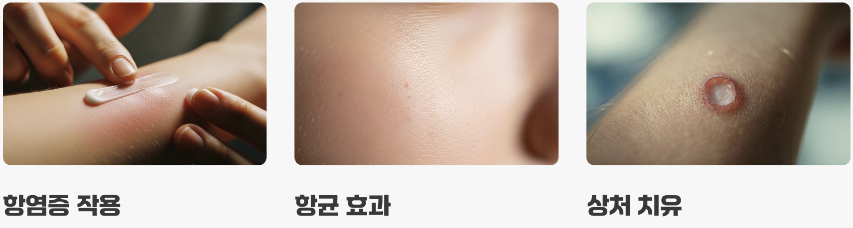 피부를 위한 최고의 '응급 처치사'