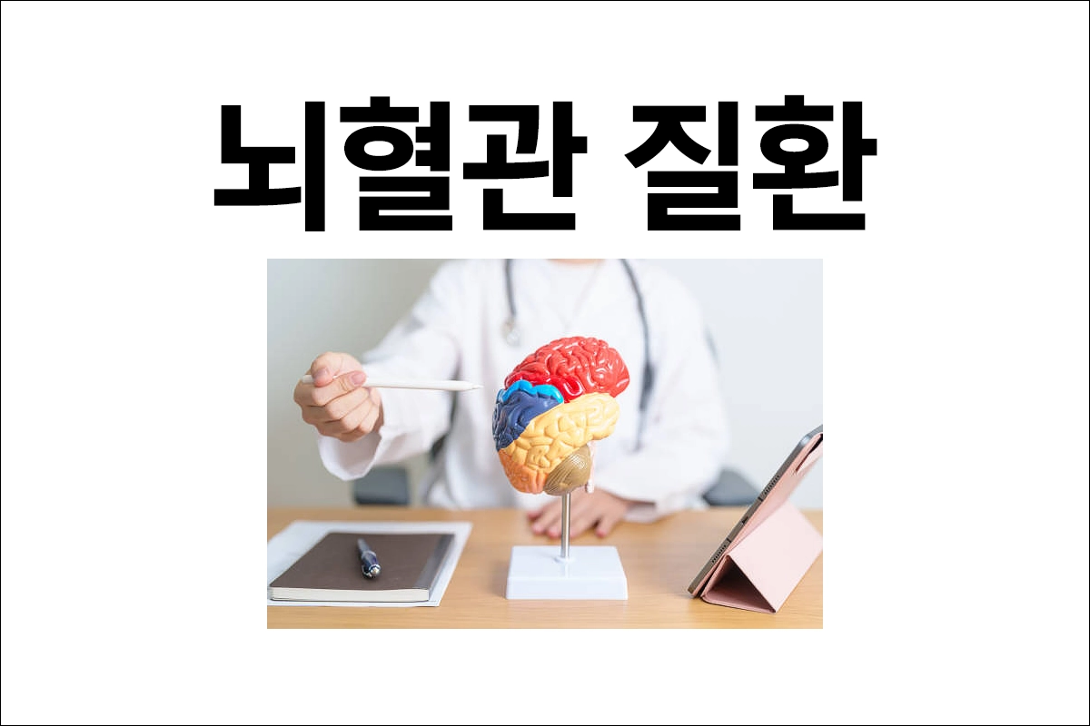 뇌혈관 질환 (뇌경색, 뇌출혈) 원인 증상 치료 예방