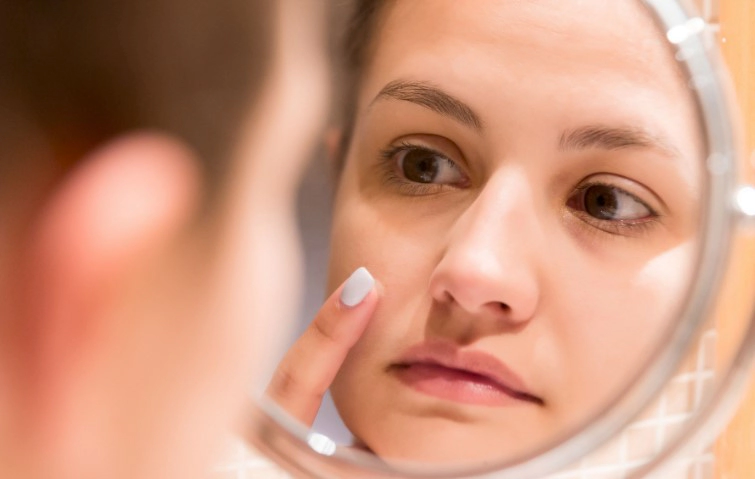 비립종 제거후 관리 방법 Tip