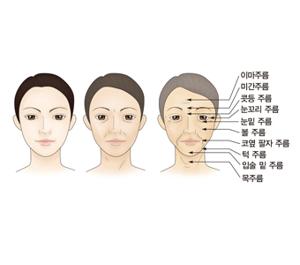 쳐진 눈