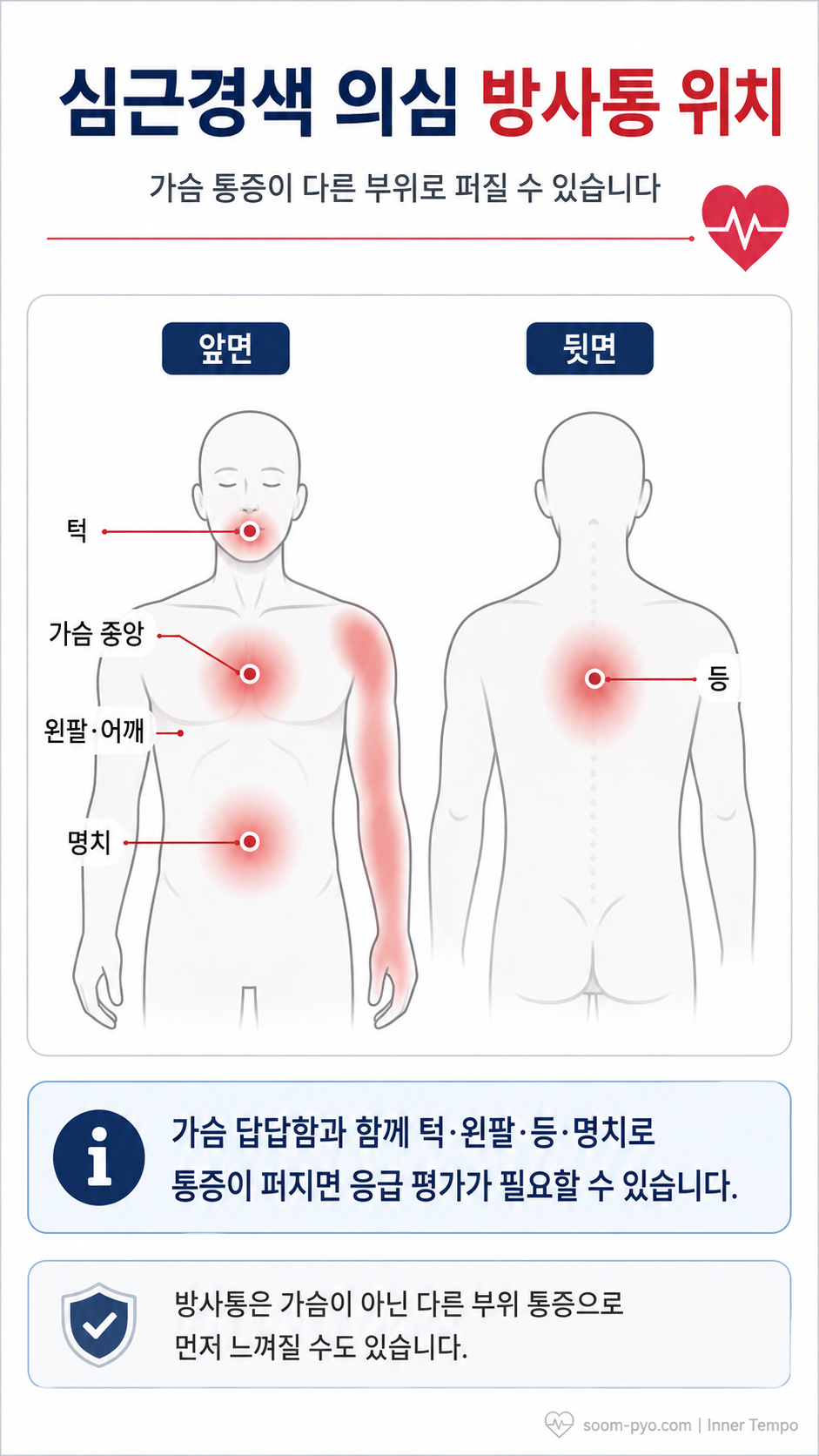 심근경색 방사통 위치 안내