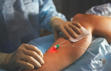 하지 정맥류 증상