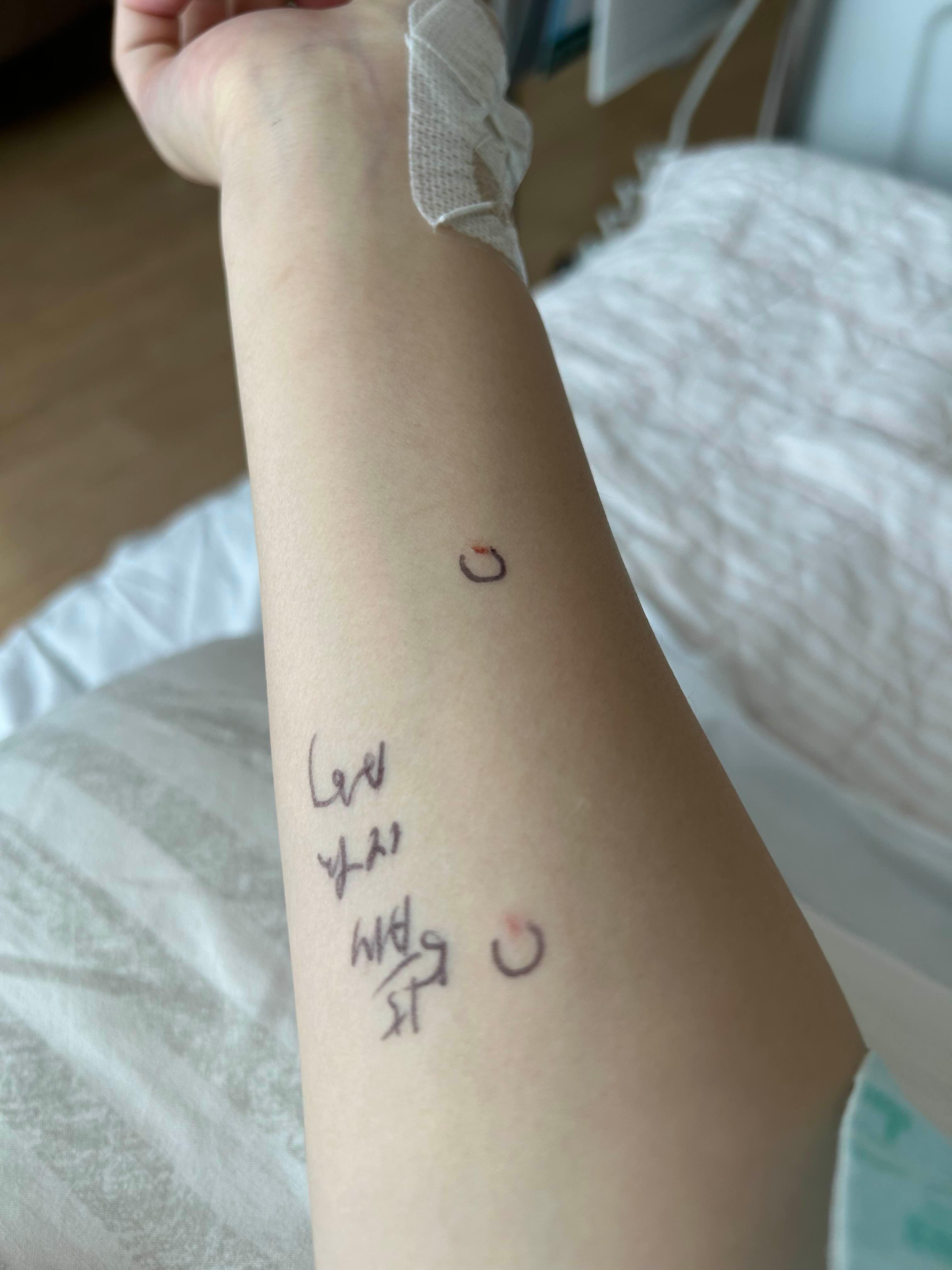 쌍둥이 임신 21주, 자궁경부 짧음