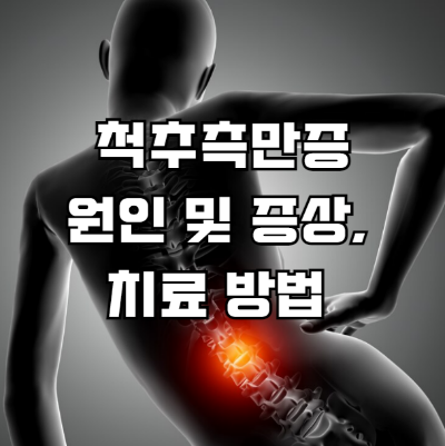 척추측만증 원인 및 증상 치료방법: 전문 가이드