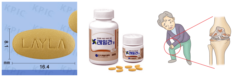 레일라정, 관절염 사진