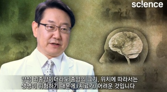 뇌종양명의
