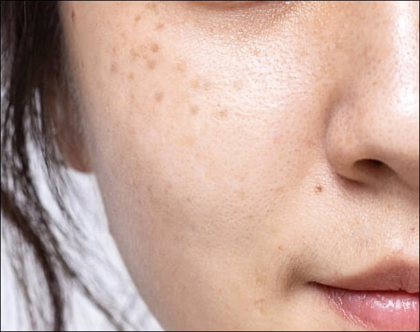 도미나 크림 사용법