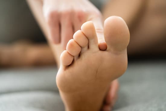 무좀·곰팡이성 피부염 완전 정리 – 재발 막는 관리법까지