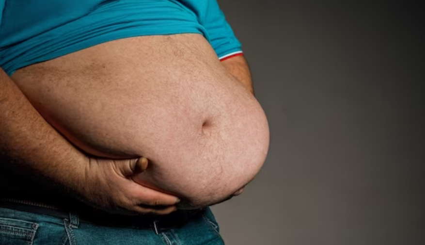 고도비만의 원인 비활동적인 생활