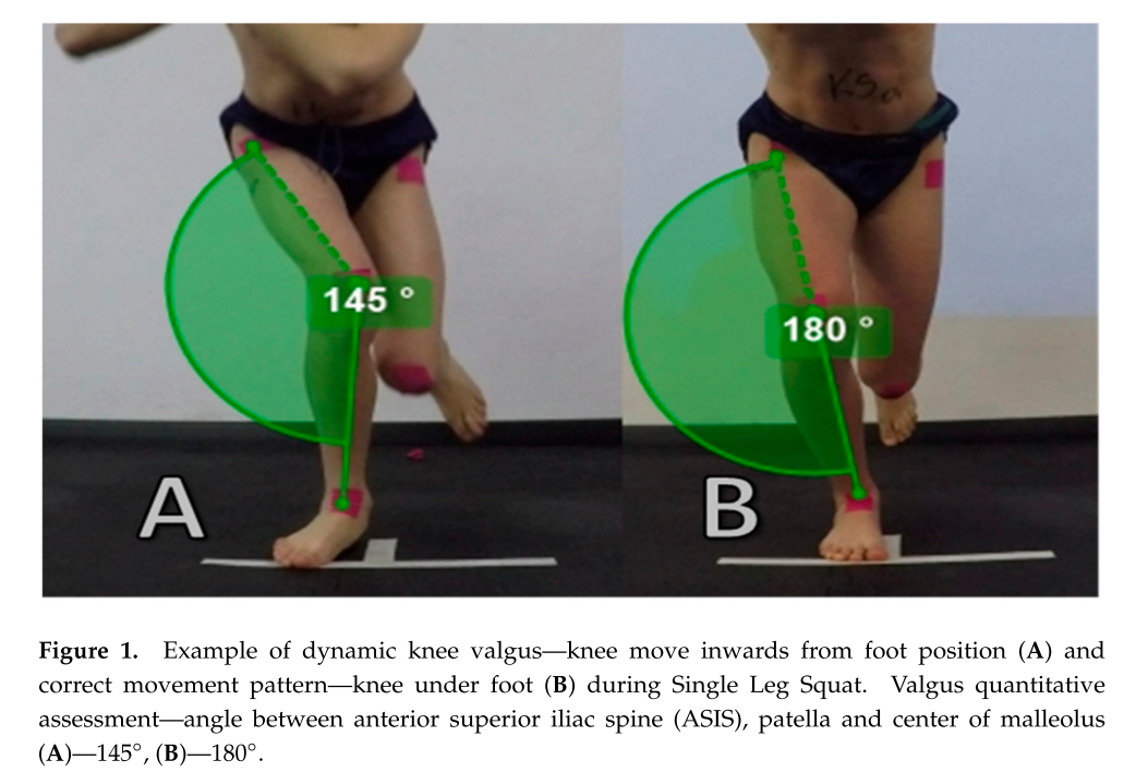 동적 무릎 외반(Dynamic Knee Valgus) 교정에 효과적인 운동법은?