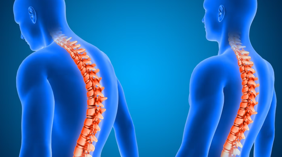 자세를 바로하여 척추측만증을 예방해요