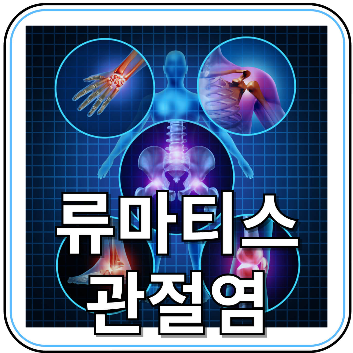 아침에 손가락이 뻣뻣하다면? 류마티스 관절염 초기 증상일 수 있어요