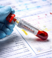 고지혈증 치료 완벽 가이드