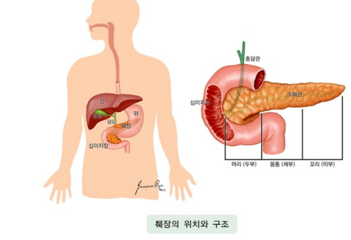 췌장-위치-사진