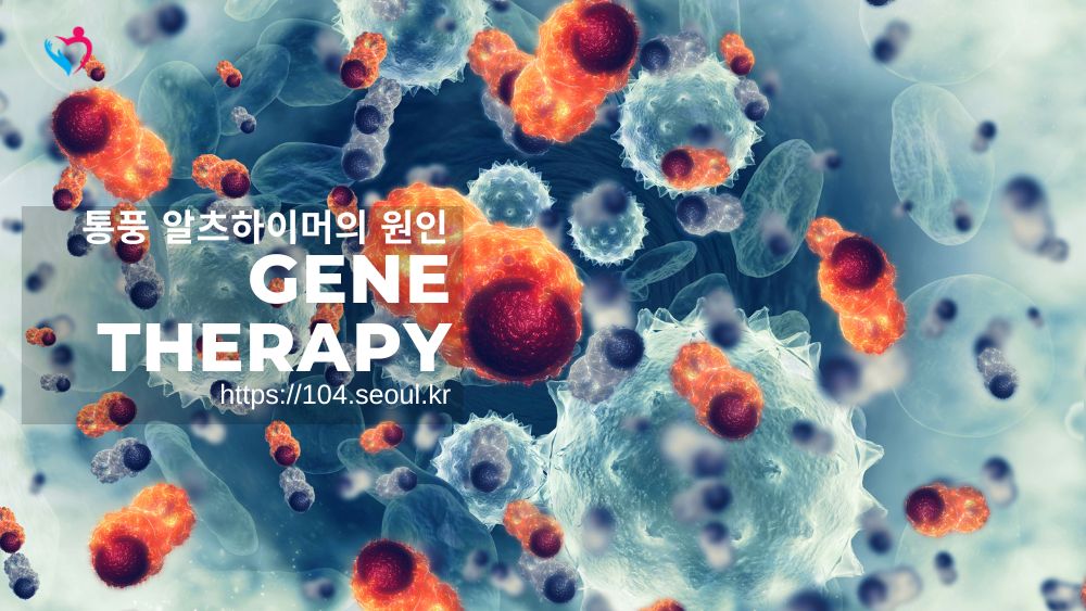 통풍 알츠하이머의 원인? 자기성분 이 발단이 되는 경악스러운 사실