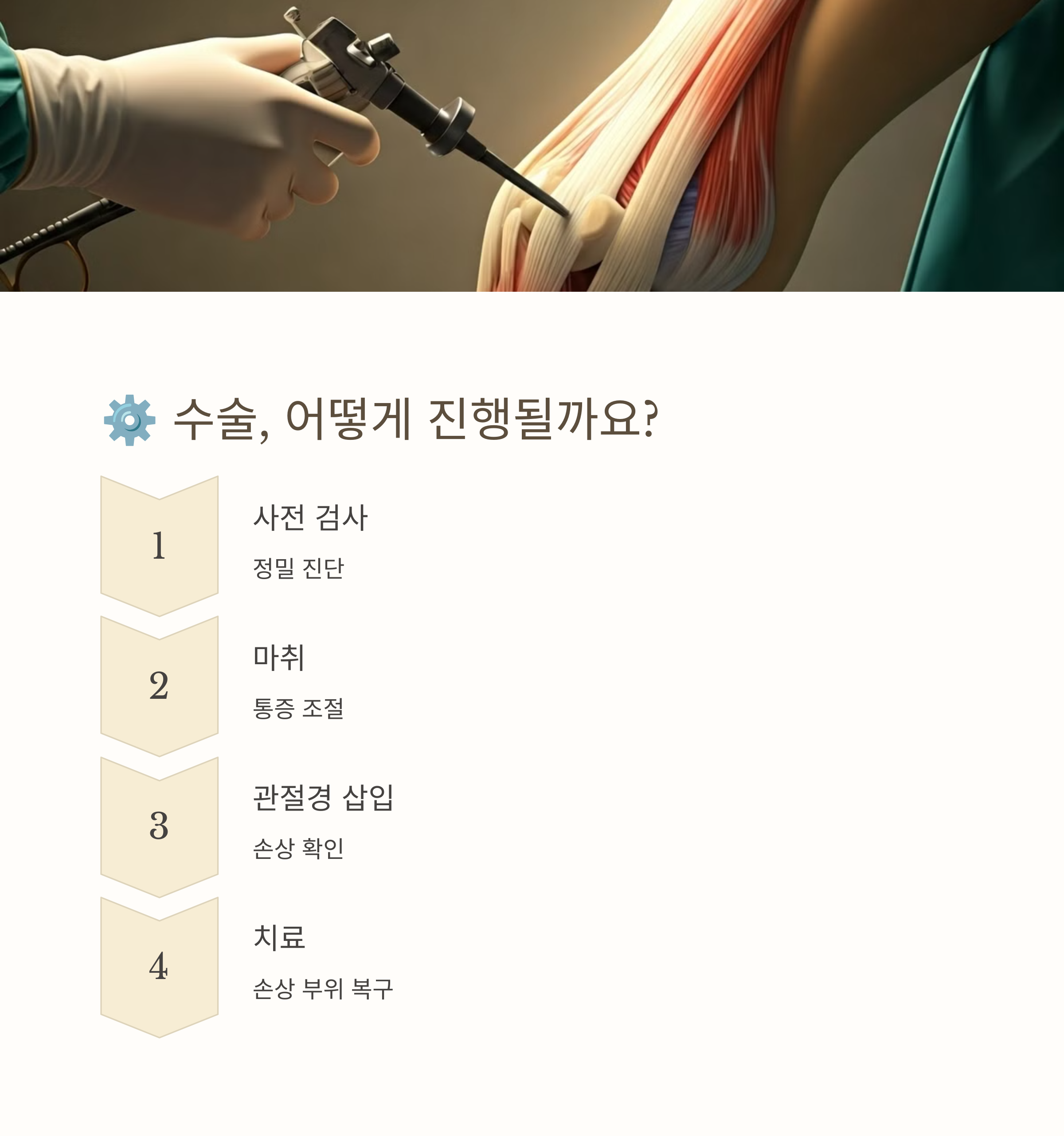 무릎 연골 수술의 모든 것