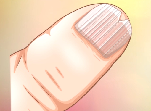 손톱에 세로줄이 생기는 이유