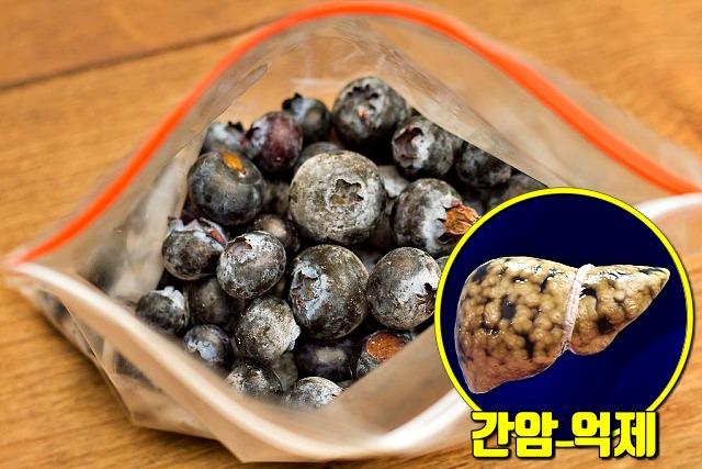 간에 좋은 음식,지방간에 좋은 음식,블루베리 효능,간암,간경화
