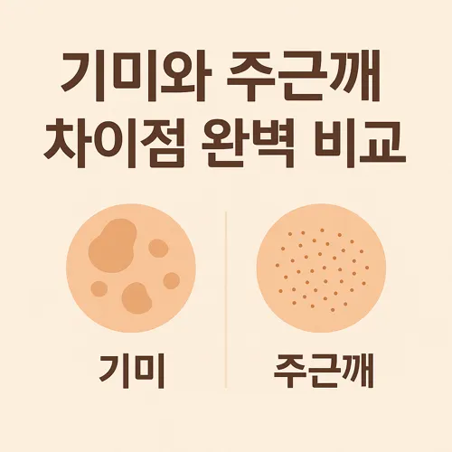 기미와 주근깨 차이를 설명하는 이미지