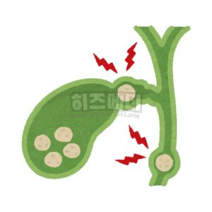 ALT수치가 높으면