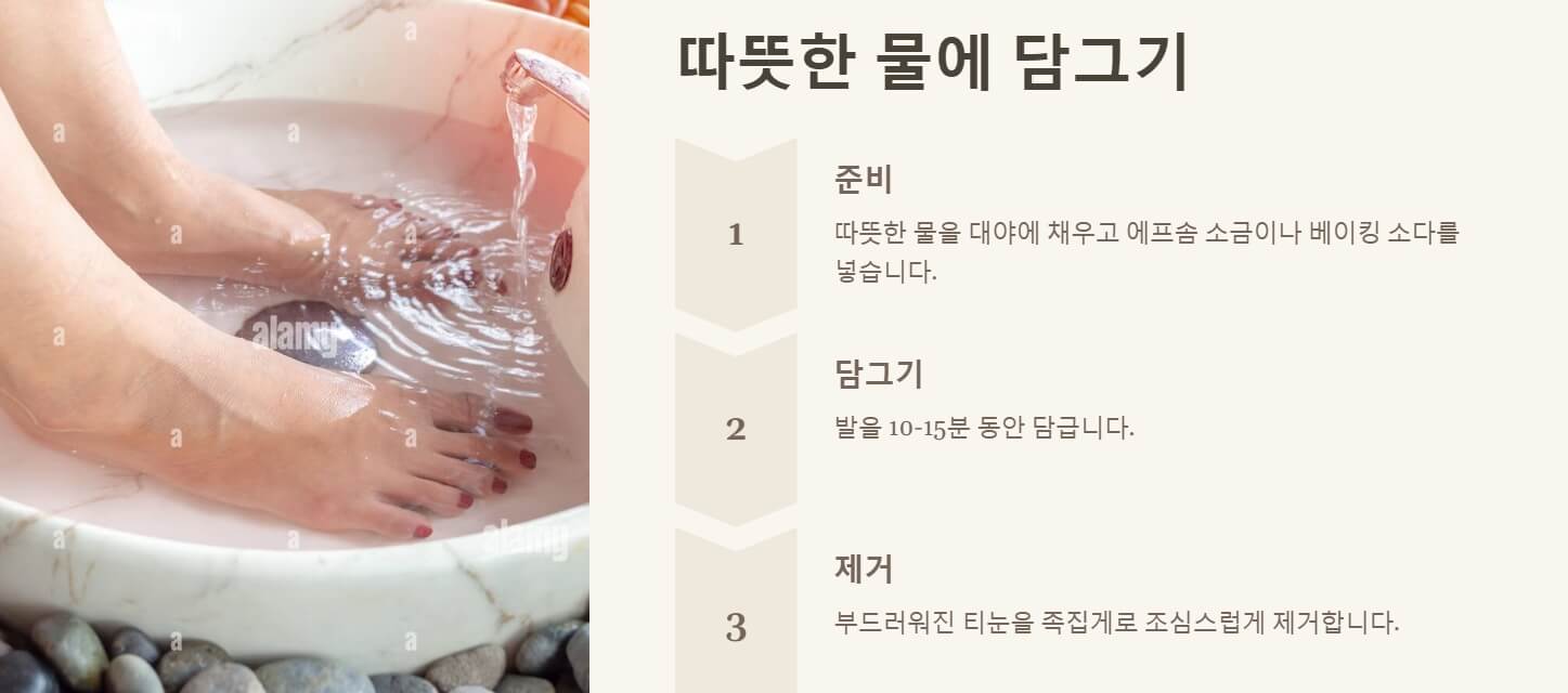 티눈 없애는 방법