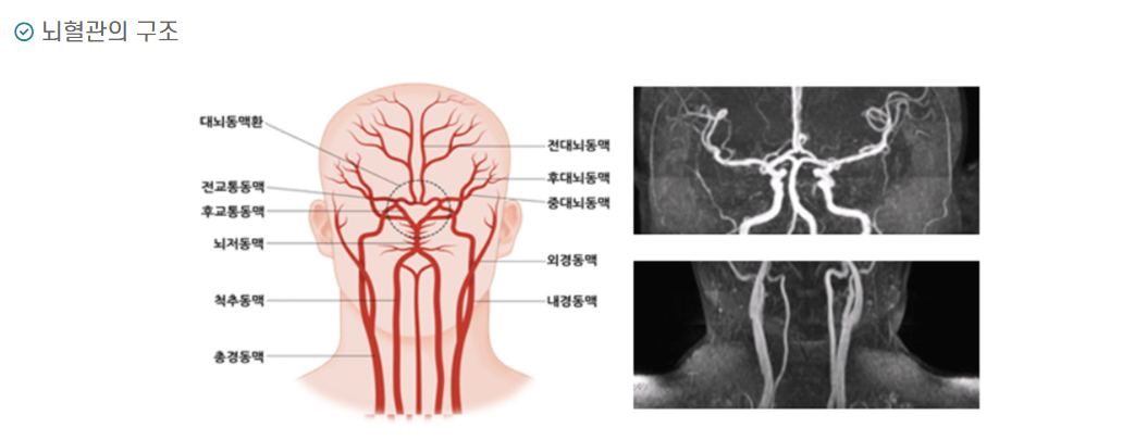 뇌졸중 전조 증상 절대 놓치면 안되는 작은 신호들