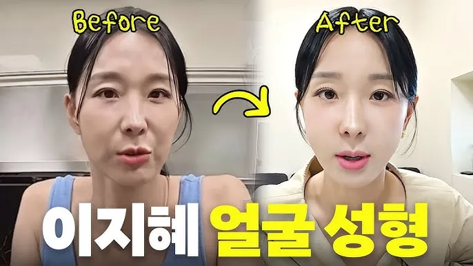 덴서티 리프팅 댄서티 가격 효과 유지기간에 관한 정보_5