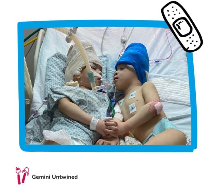 머리 붙은 세 살배기 쌍동이 수술 성공적 분리...전세계 의사들, '가상현실'에서 함께 참여 VIDEO: Conjoined twins separated with the help of virtual reality