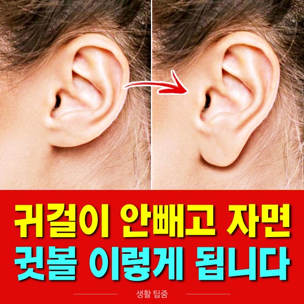 '귀걸이 안빼고 자면' 귓볼 이렇게,반지 목걸이 주얼리 브랜드