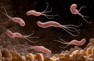 헬리코박터-파일로리-의심-신호-검사-가이드