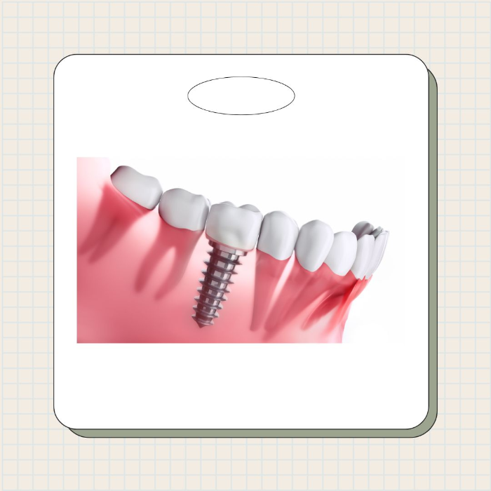 세종 임플란트 치과
