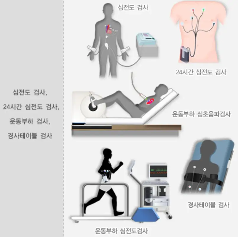 부정맥-심전도검사-이미지