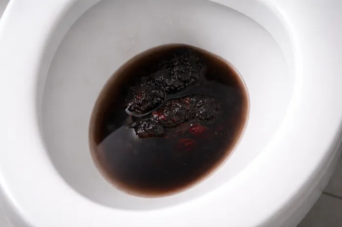 위염 증상과 위궤양 증상