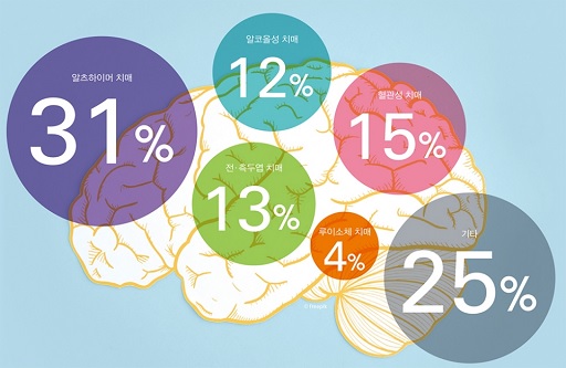 초로기 치매의 이해를 돕기 위한 치매 종류