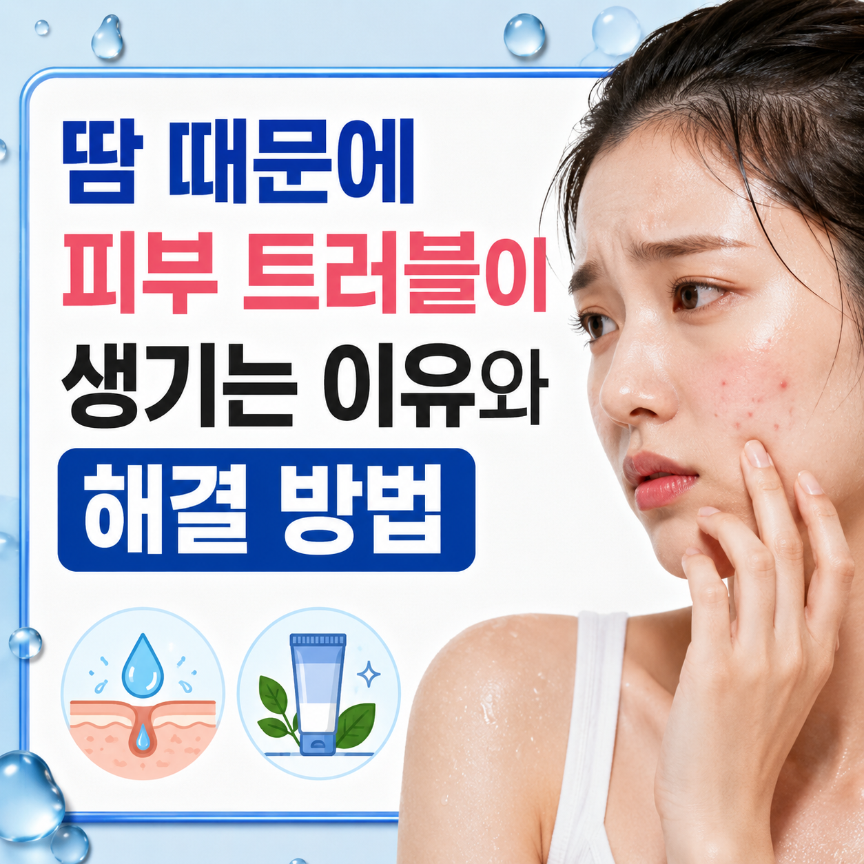 땀 피부 트러블