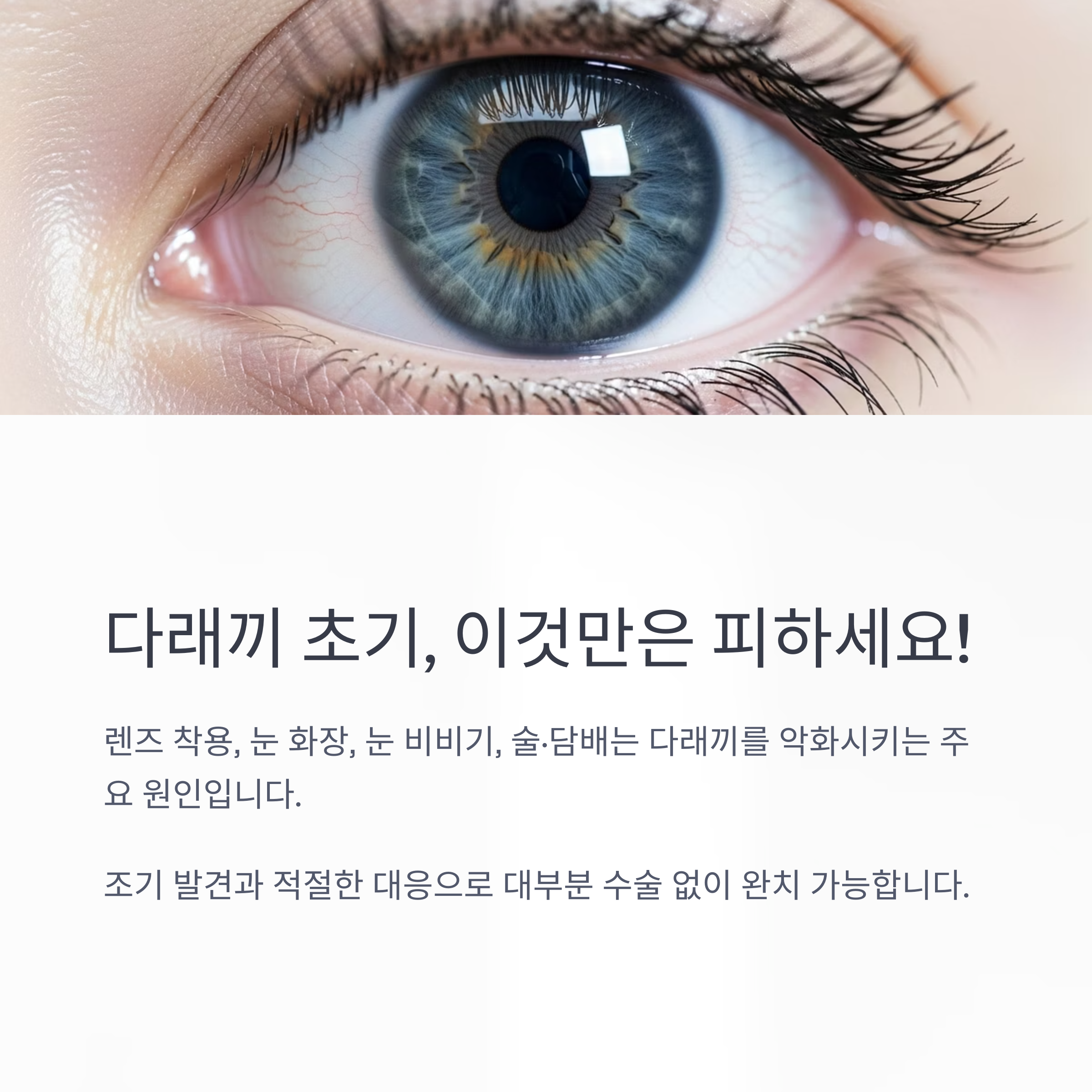 다래끼 초기, 이것만은 피하세요!