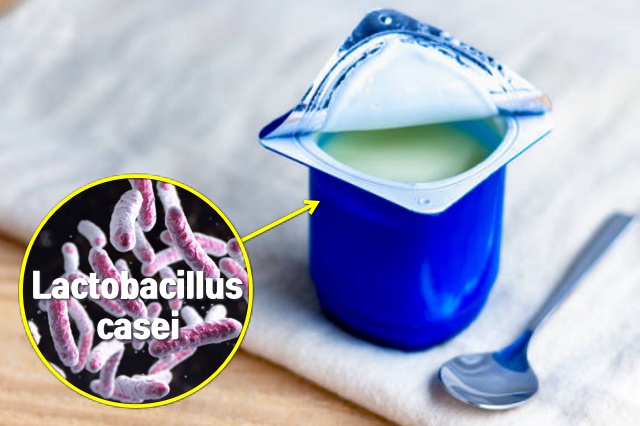 유산균 효능 장에 독소가 쌓이면, 장독소배출방법 장독소자가진단, 장게실염 대장암, 건강 팁줌 매일꿀정보