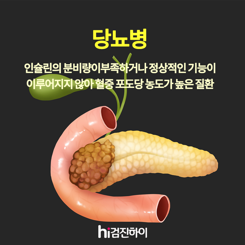 당뇨병 진단기준 원인