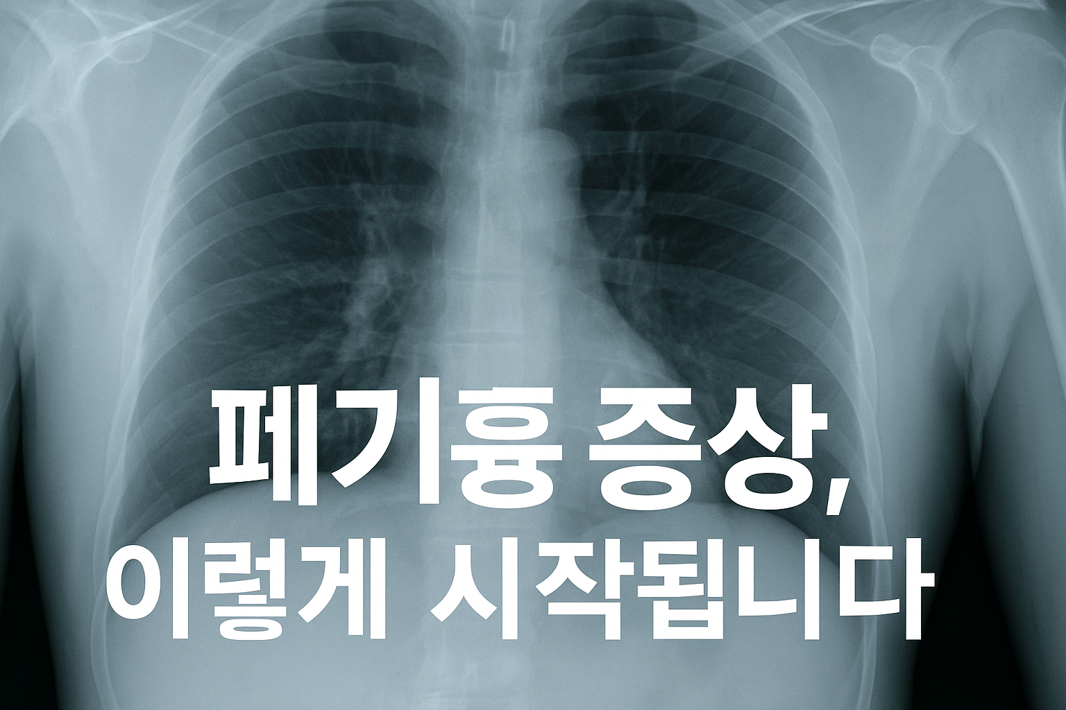 폐기흉 증상
