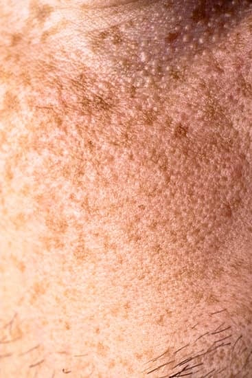 우드 램프 검사(Wood's Lamp Test): 개요 및 사용법