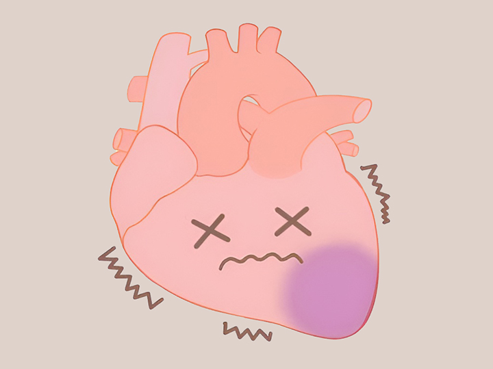 문제가-있는-심장