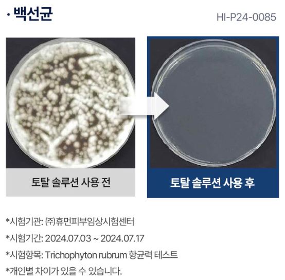 라셀턴 특징 효과