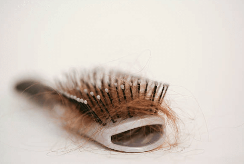 탈모 원인과 예방방법